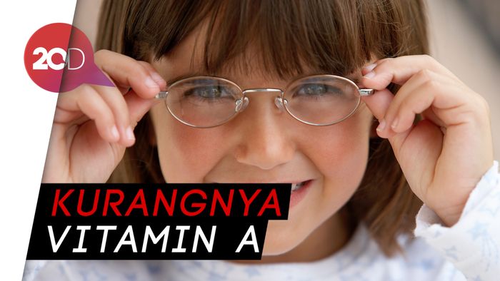 Hati-hati! Anak Dapat Terserang Rabun Ayam