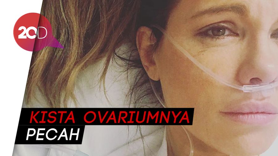 Dilarikan ke RS, Kista Ovarium Kate Beckinsale Pecah 