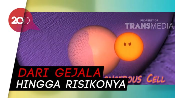 Mengenal Lebih Dalam Kanker Darah yang Diderita Ani Yudhoyono
