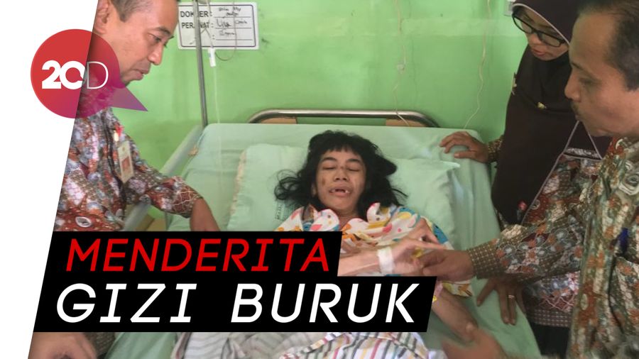 Kasihan, Gadis di Mojokerto Hampir Tersisa Tulang dan Kulit