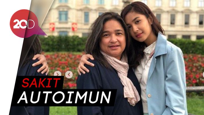 Ibunda Mikha Tambayong Meninggal Dunia