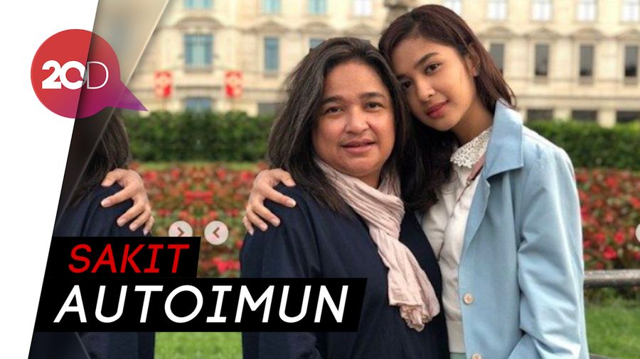 Ibunda Mikha Tambayong Meninggal Dunia