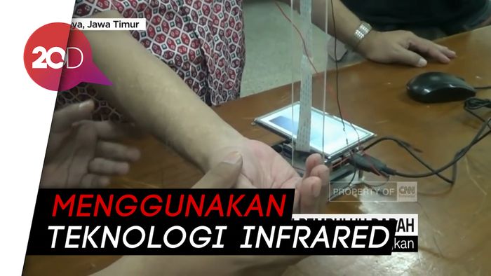 Keren! Alat Pendeteksi Pembuluh Darah Karya Mahasiswa Surabaya