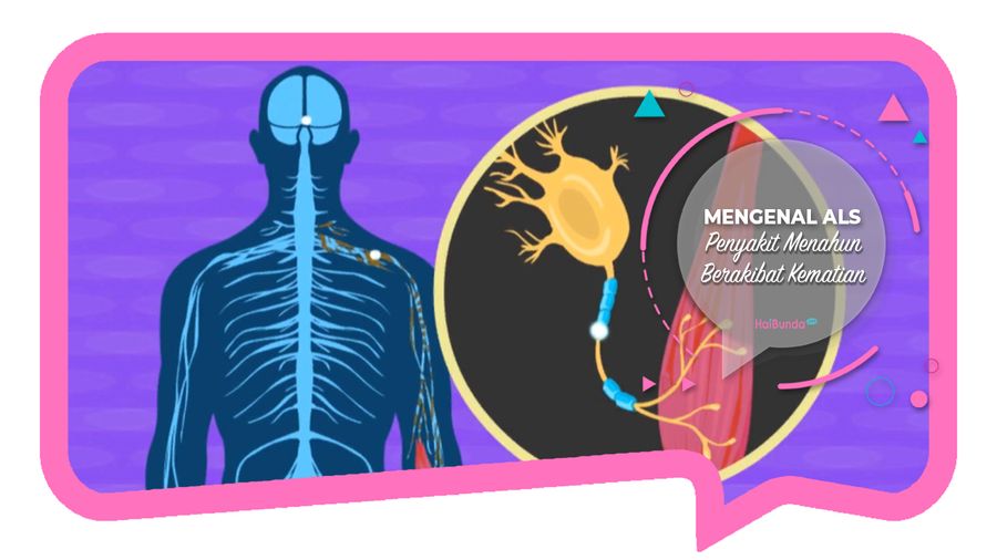 Mengenal ALS, Penyakit Menahun Berakibat Kematian