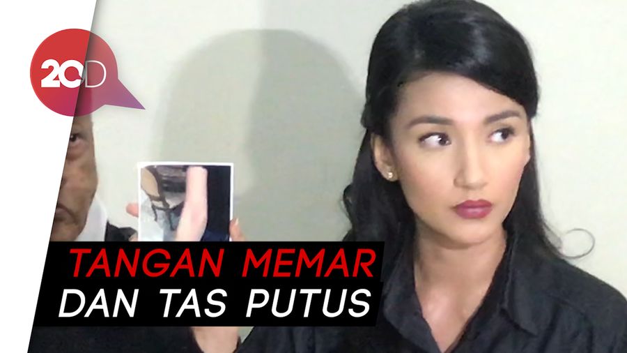 Dianiaya Atalarik Syah, Tsania Marwa Langsung Lapor Polisi