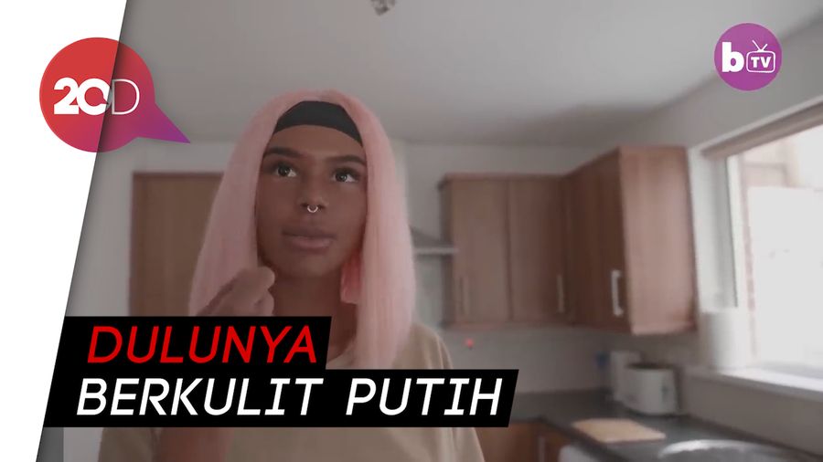 Kisah Bule Cantik Kecanduan Tanning, Kulitnya Jadi Hitam Legam
