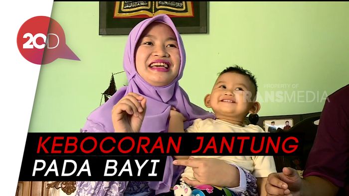 Catet! Bahaya Rubela Saat Hamil