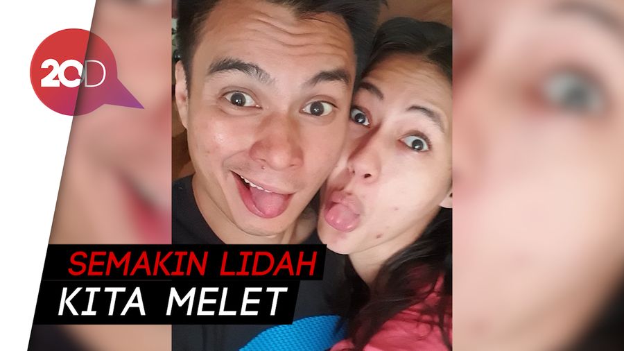 Baim Wong Tanggapi Kasus Disomasi Manajemen Artis dengan Pose Melet