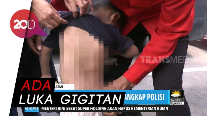 Tega! Balita Dianiaya Bapak Tiri Pakai Selang Air