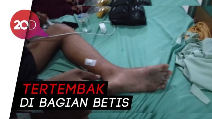 Dua Remaja di Tegal Ditembak Senapan Angin saat Ronda Sahur