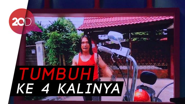 Sel Tumor Kembali Tumbuh, Begini Kondisi Terakhir Agung Hercules