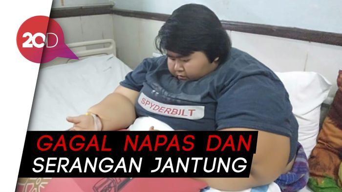 Yunita, Gadis Berbobot 142 Kg Meninggal di RS