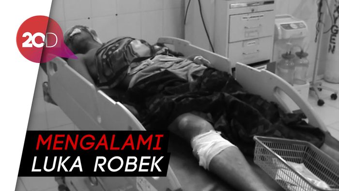 Ngeri! Pria di Jambi Diterkam 4 Ekor Beruang