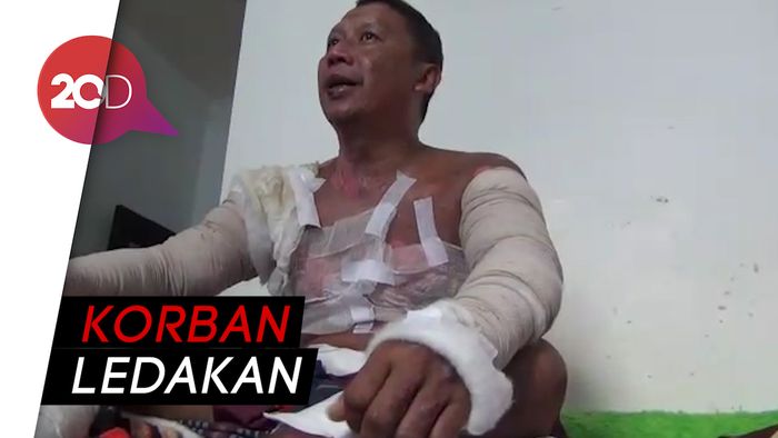 Waduh! Tubuh Pria Ini Terbakar Usai Bakar Sampah