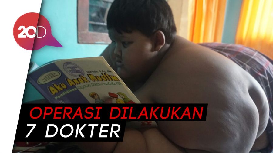 Buang Gelambir, Arya Bocah Obesitas Jalani Operasi Brapio Plastic