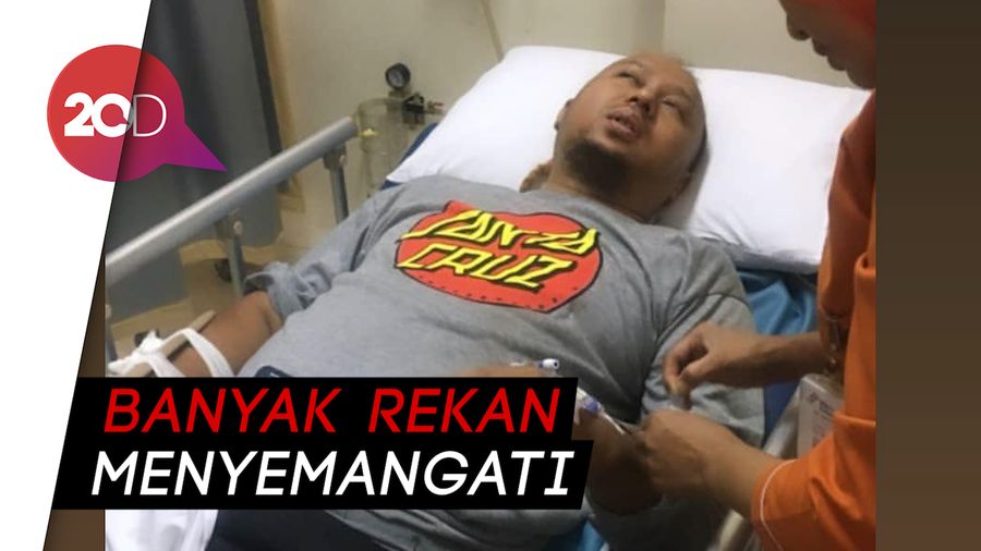 Kecelakaan, Sutradara Anggy Umbara Dikabarkan Patah Tangan dan Kaki