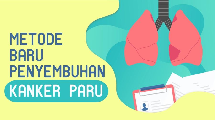 Imunoterapi, Terobosan Pengobatan Baru untuk Penderita Kanker