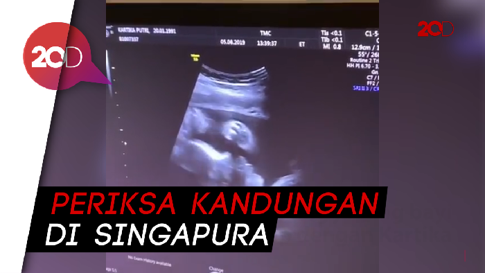 Kartika Putri Kaget Lihat Hasil USG Si Jabang Bayi