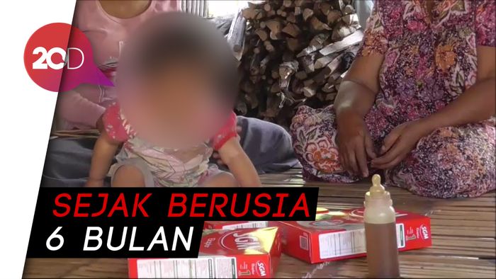 Prihatin! Ortu Tak Mampu Beli Susu, Bayi 14 Bulan Diberi Kopi