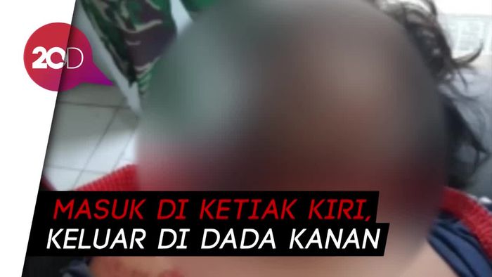 Tim Forensik: Randi Tewas Akibat Peluru Menembus Dada