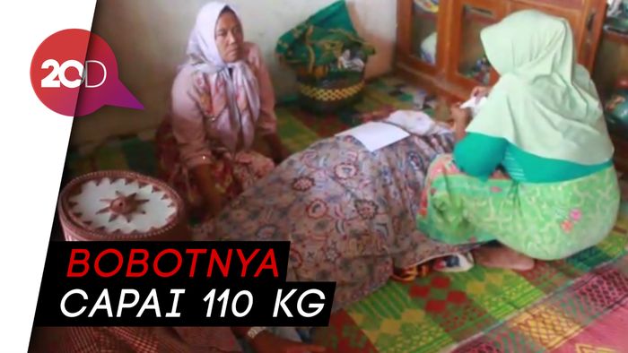 Bocah Obesitas Satia Putra Meninggal Dunia