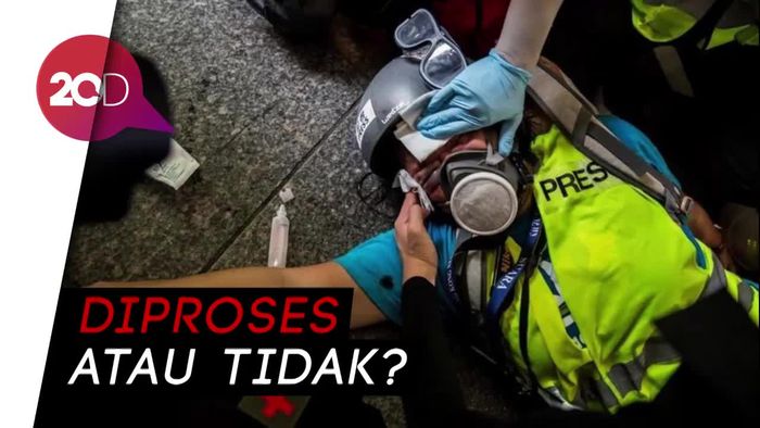 Jurnalis WNI yang Tertembak di Hong Kong Terancam Buta