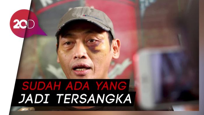 Dalami Kasus Penculikan Ninoy Karundeng, Polisi Periksa Sekjen PA 212