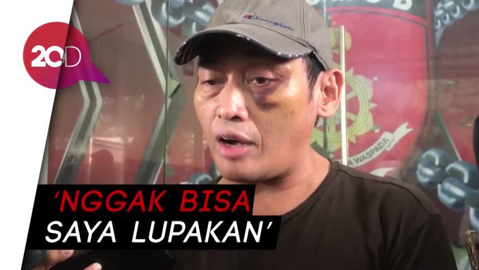 Ninoy Karundeng Trauma Dianiaya, Tak Berani Tempati Rumah