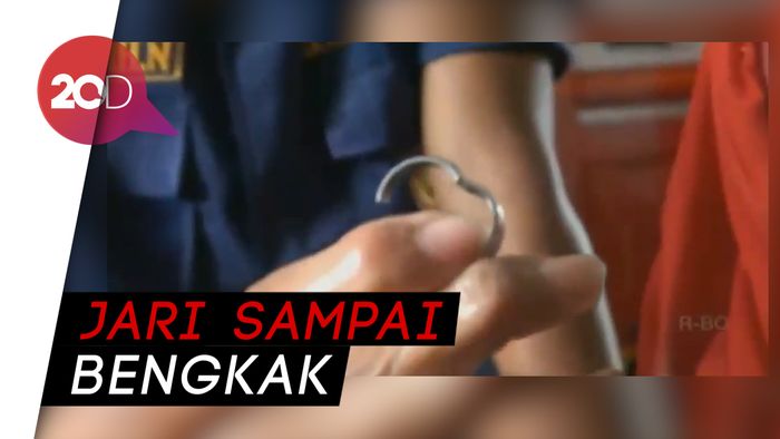 4 Tahun Jari Terjepit Cincin, Ibu ini Minta Bantuan Damkar