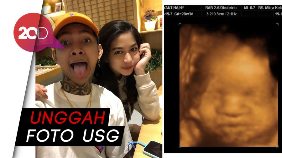 Young Lex Ternyata Sudah Nikah, Istrinya Hamil 7 Bulan