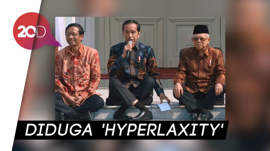 Penjelasan soal Viral Posisi Duduk Jokowi yang Fleksibel