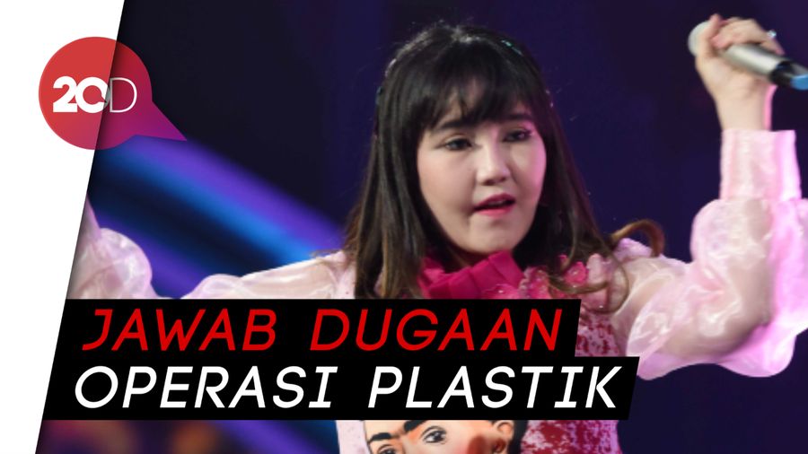 Via Vallen Jelaskan soal Penampilannya yang Bikin Pangling