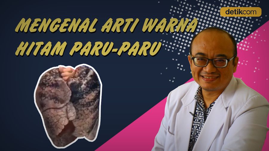 Kenali Penyebab Paru-paru Bisa Menghitam