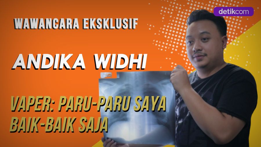 Bersiteguh Vape Aman, Vaper Ramai-ramai Pamer Rontgen Dada