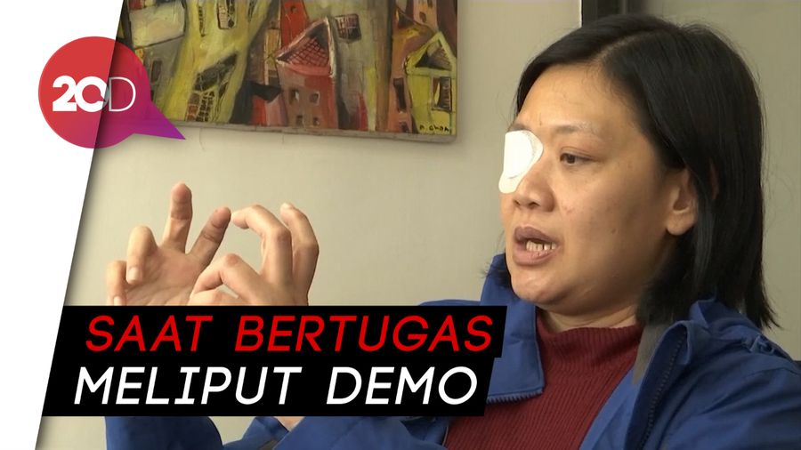 Cerita Jurnalis Indonesia, Buta Ditembak Polisi Hong Kong