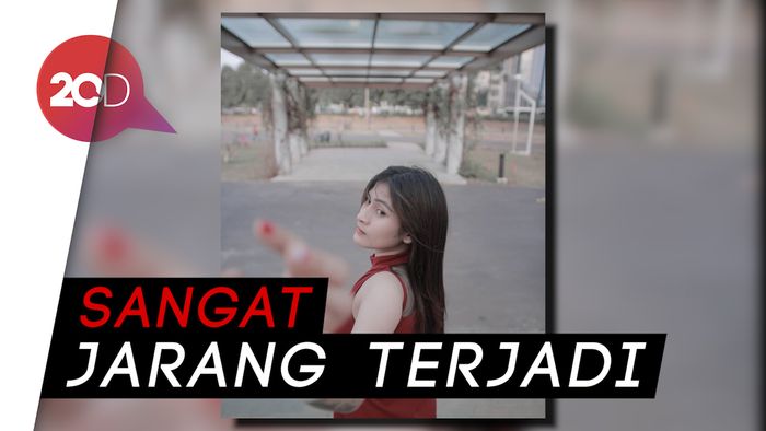 Dokter Jantung Jelaskan Soal Desy Nurhakiki yang Meninggal di Usia Muda