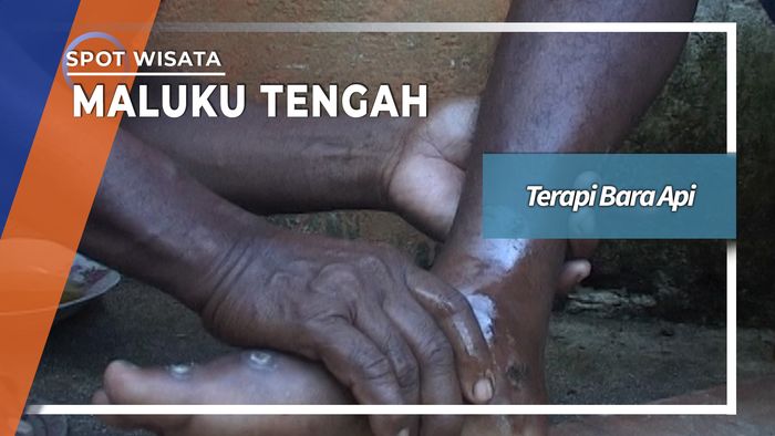 Tradisi Pengobatan Patah Tulang Dengan Bara Api Maluku Tengah