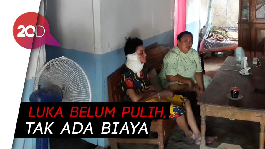 Ungkapan Traumatis Istri yang Dibakar Hidup-hidup oleh Suami