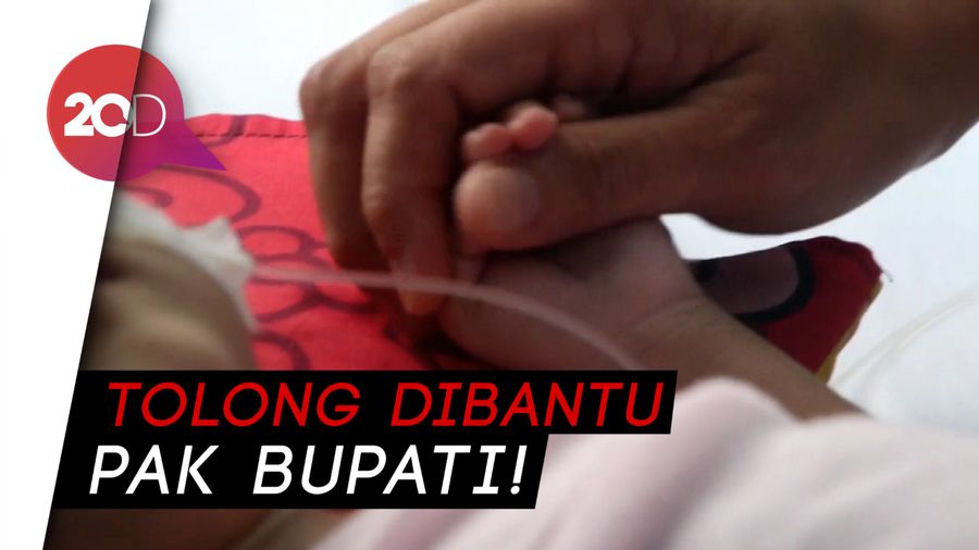  Kisah Rahma, Anaknya Derita Gizi Buruk dan Ditinggal Suami