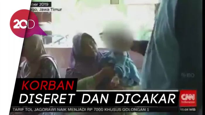 Akibat Serangan Kera Liar, Seorang Bayi Alami Luka di Kepala