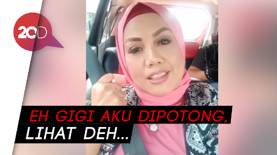 Elly Sugigi Potong Gigi, Bantah Habiskan Ratusan Juta