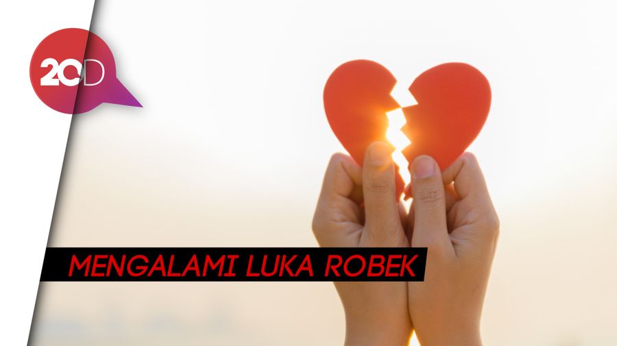 Tolak Ajakan Balikan, Jumiyati Ditikam Mantan Kekasih