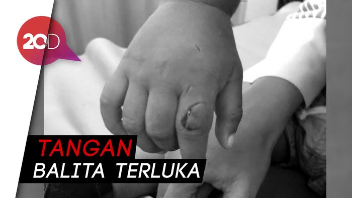 Kalapas Wanita Bandung Buka Suara soal Balita Digigit Ikan Aligator