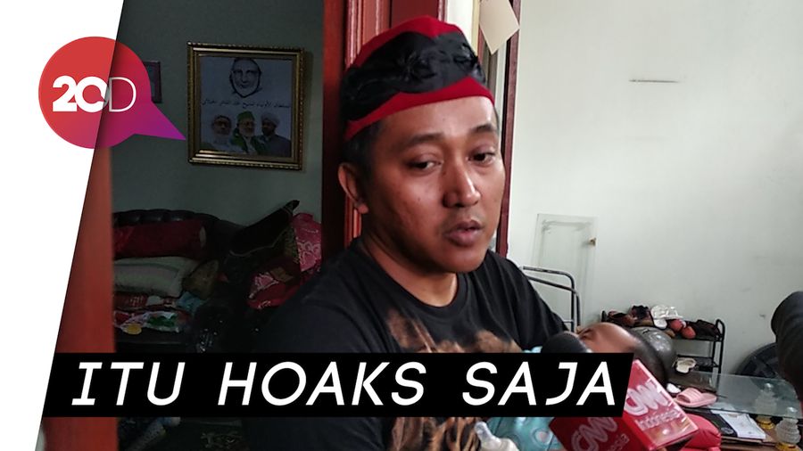Teddy Bantah Isu Lebam di Tubuh Lina