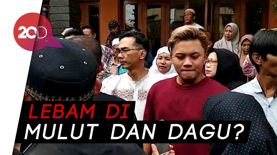 Ditanya soal Lebam di Tubuh Lina, Ini Jawaban Pihak RS