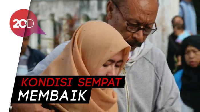 Bayi yang Diviralkan Neneknya Gegara Hidrosefalus Meninggal