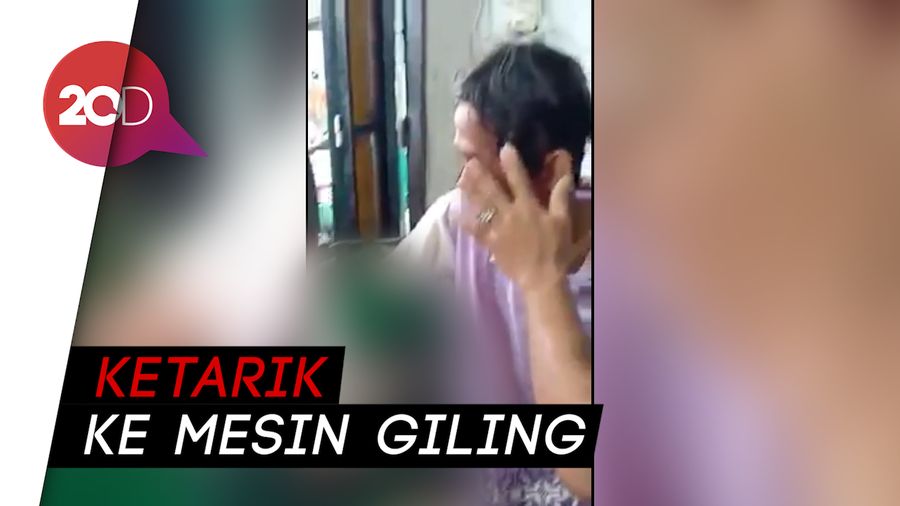 Lalai, Tangan Pria Ini Kegiling Mesin Daging