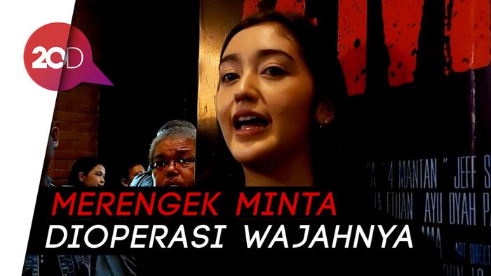 Ranty Maria Pernah Di-bully Gegara Punya Freckles di Muka