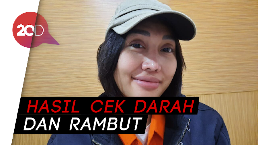 Tak Hanya Benzo, Lucinta Luna Positif Konsumsi Amfetamin 