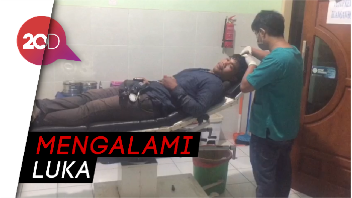  Liput Tawuran, Jurnalis di Baubau Terkena Lemparan Batu